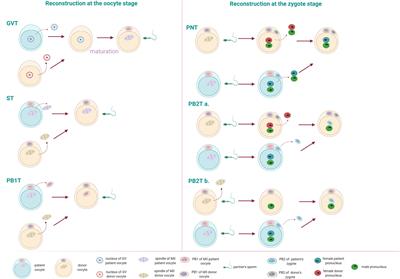 Prospects of Germline Nuclear Transfer in Women With Diminished Ovarian Reserve